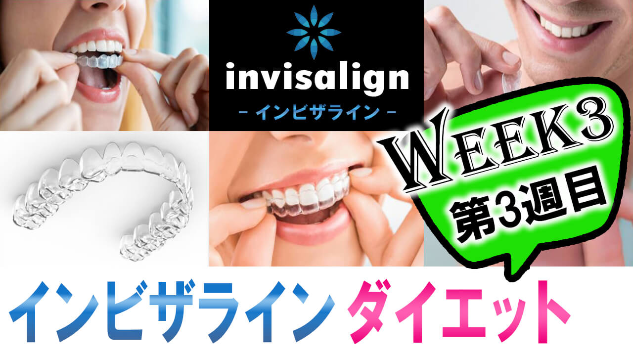 invisalign_03