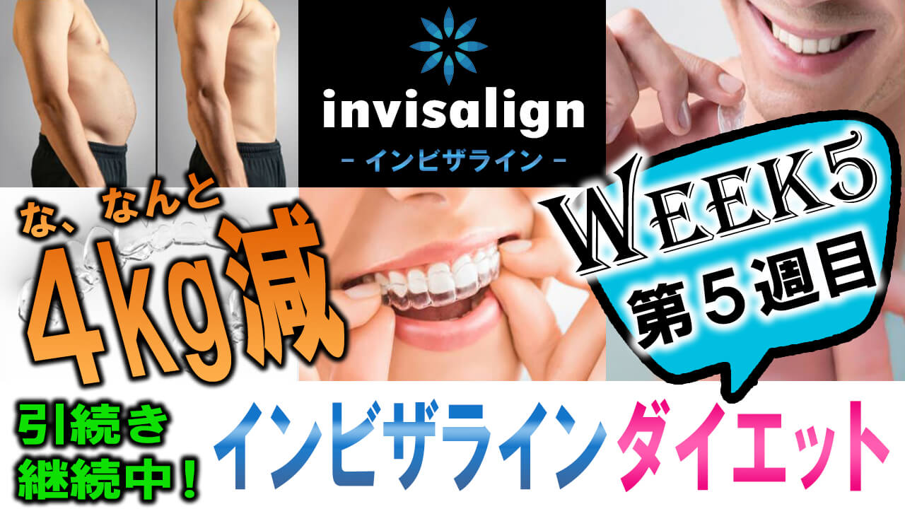 invisalign_05