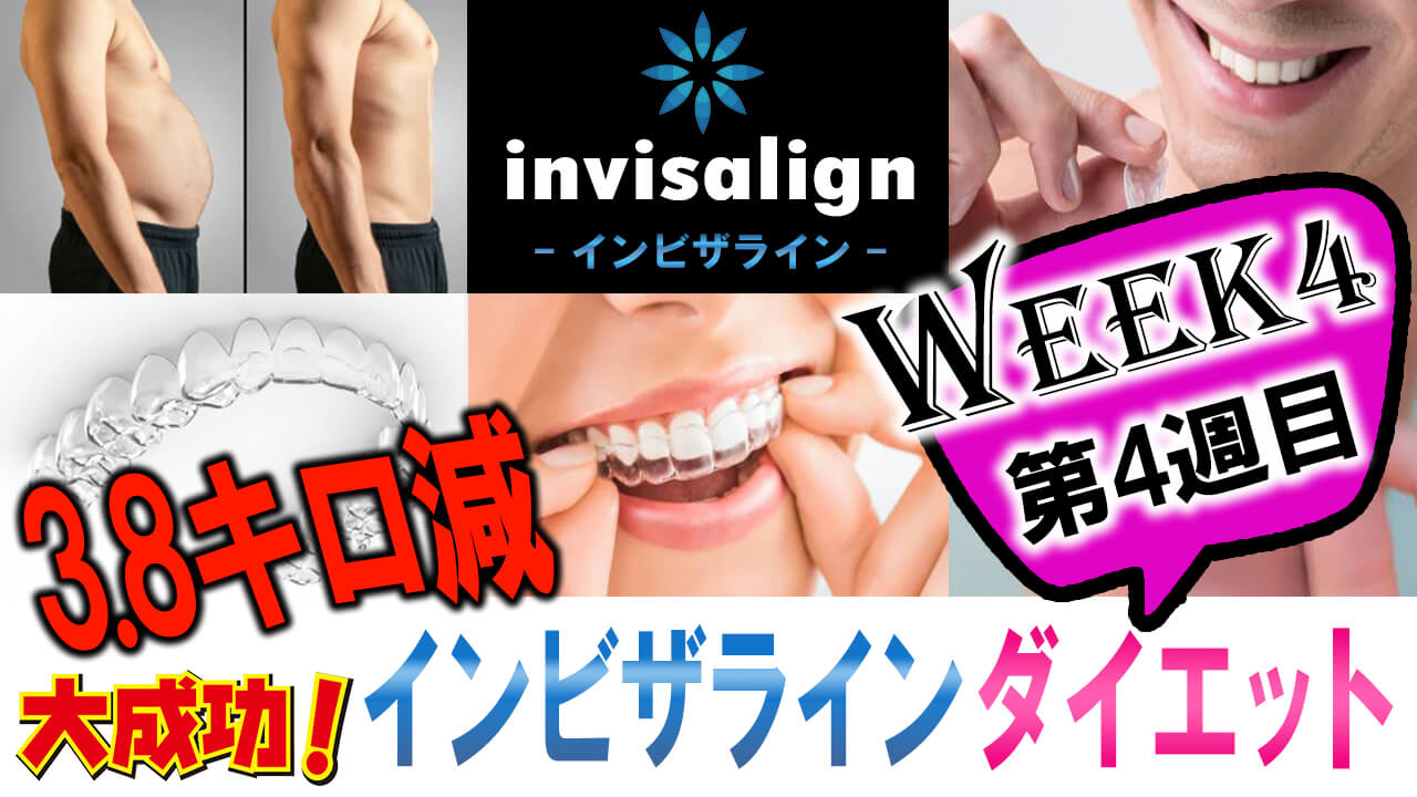 invisalign_04_thamune